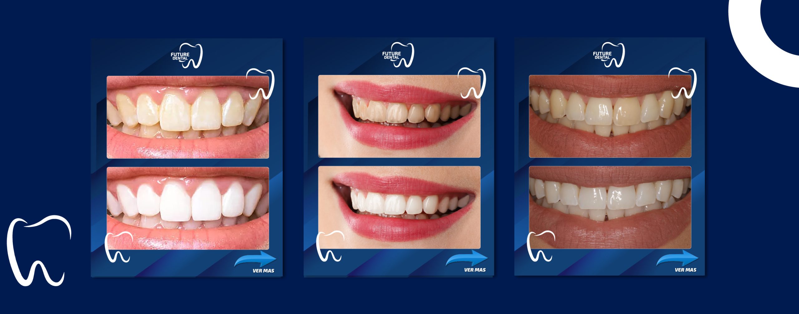 Logos Pngblanqueamienrto carrusel-100